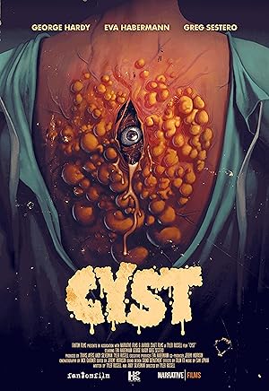 Cyst poster